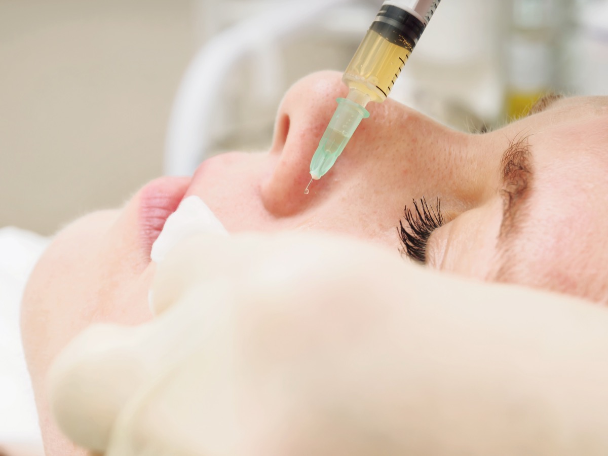 Mesotherapie Behandlung